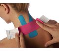 Випадок використання стрічки kinesio tape при спастичній кривошиї