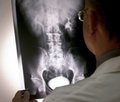 Діагностика та лікування спинномозкової травми