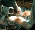 Место Сульбактомакса в лечении больных с хирургическими инфекциями