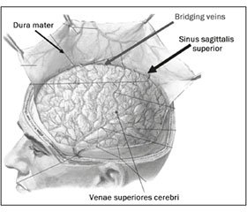 Постпункционная головная боль: этиология, патогенез, проявления