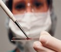 Glial protein s100 and total nitric oxide blood level indexes features in small premature infants with perinatal hypoxic-ischaemic encephalopathy