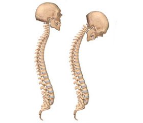 Duality of Genesis of Osteopenic Syndrome in Patients with Central Form of Ankylosing Spondylitis Complicated by Gastroesophageal Reflux