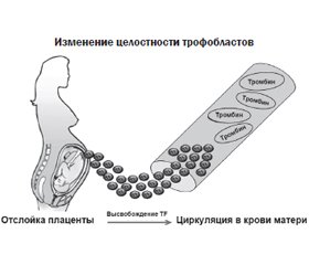 Патогенез и лабораторная диагностика ДВС-синдрома в акушерстве