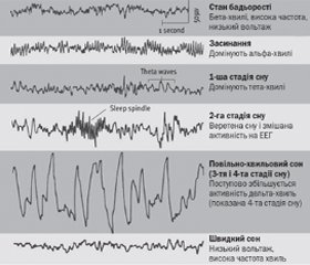 Найбільш поширені розлади сну у дітей та підходи до їх фармакологічної та нефармакологічної корекції