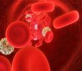 Development of thrombosis in child hood acute lymphoblastic leukemia