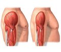 Pitfalls in the Development of Drugs in Sarcopenia