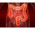 Large intestinal motility and tone of the intestinal walls in chronic non-ulcerative colitis in children