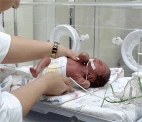 The state of lipid peroxidation and antioxidant defense system in newborns requiring artificial lung ventilation