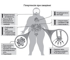 Стратегії схуднення для профілактики та лікування гіпертензії. Наукова заява Американської асоціації серця