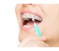 The role of interdental hygiene in supporting oral health