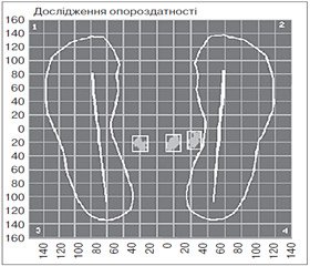 Динаміка біомеханічних та електроміографічних даних у випадках деформацій великого вертлюга стегнової кістки