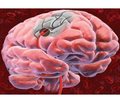 Нейропротекція при гострому ішемічному інсульті: від нейрофармакології до фармакотерапії