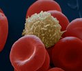 Leukocyte composition and immunophenotype of peripheral blood lymphocytes of DAAb-positive and DAAb-negative children with diabetes-associated autoantibodies (DAAbs) in preclinical and early clinical stages of type 1 diabetes mellitus.