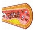 Влияние на эндотелиальную дисфункцию — новая стратегия превентивной кардионеврологии