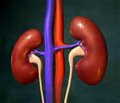 Immunoadsorption and Its Application for Desensitizing Incompatible Kidney Transplant Candidates Who Have a Potential Living Donor