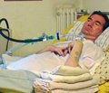 Использование эверолимуса для лечения ангиомиолипомы, обусловленной туберозным склерозом или спорадическим лимфангиолейомиоматозом: многоцентровое рандомизированное двойное слепое плацебо-контролируемое исследование (EXIST-2)