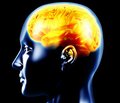 Эффективность и безопасность Эпилептала® у больных с посттравматической эпилепсией
