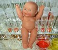 Особенности анамнеза женщин с предшествующими вмешательствами на придатках матки, обратившихся для лечения бесплодия с использованием ВРТ