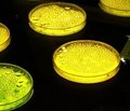 Катионные антимикробные пептиды системы неспецифической защиты респираторного тракта: дефензины и кателицидины Дефензины — молекулы, переживающие ренессанс (Часть 4)