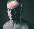 Характеристики произвольных саккад при различных клинических формах и стадиях болезни Паркинсона