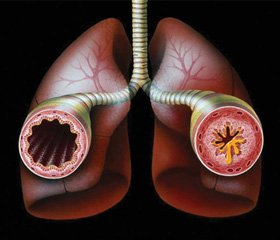 Фармакогенетичні аспекти дезобструктивної терапії нападів бронхіальної астми в школярів