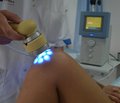 Современные подходы в лечении посттравматического остеомиелита длинных костей