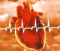 Руководство по диагностике и лечению гипертрофической кардиомиопатии: отчет рабочей группы Американского общества кардиологии/Американской ассоциации кардиологов (ACCF/AHA) по разработке практических рекомендаций — 2011