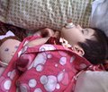 Динамика заболеваемости эпилепсией и эпилептическими синдромами у младенцев и детей в Автономной Республике Крым за 5 лет (2007–2011 гг.)