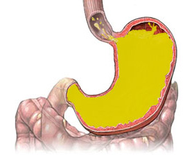 ebook pathophysiology of