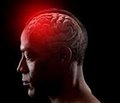 Взаимосвязь между наличием метаболического синдрома и наличием спонтанного внутричерепного кровоизлияния