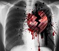 Личностные особенности, повышающие риск развития инфаркта миокарда