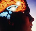 Применение Церебролизина для лечения пациентов с острым ишемическим инсультом в Азии Результаты двойного слепого плацебо-контролируемого рандомизированного исследования