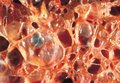 Технологические усовершенствования применения низких температур при лапароскопических операциях у больных с патологией гепатобилиарной системы