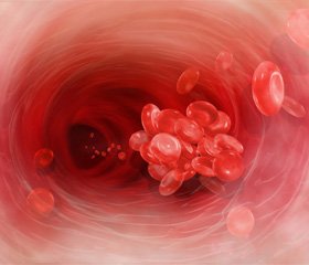 Принципы рациональной инфузионно-трансфузионной терапии при массивной кровопотере в гинекологии