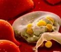Исследование минеральной плотности кости, костных биохимических маркеров и переломов на большой выборке взрослых больных муковисцидозом в Российской Федерации