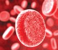 Парализатор гликопротеина плазмы крови может уменьшить проявления эмболии после каротидного стентирования