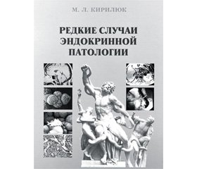 Редкие случаи эндокринной патологии