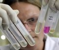 Антигіпертензивна ефективність фіксованої комбінації валсартану та амлодипіну (препарату Ексфорж) у пацієнтів з артеріальною гіпертензією (результати багатоцентрового дослідження)