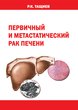 Первичный и метастатический рак печени