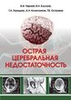 Острая церебральная недостаточность