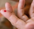 Несахарный диабет: эпидемиология, диагностика, клиническая симптоматика, лечение