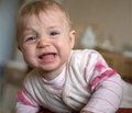 Невропатия лицевого нерва и прозопарезы у детей