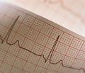 Современные подходы к лечению постинфарктных больных