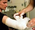Переломи, що не зрослися, та псевдоартрози