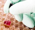 Лабораторна діагностика функціонального дефіциту заліза