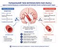 Анестезіологічне забезпечення операцій на верхній кінцівці в положенні «пляжного крісла»: огляд сучасних підходів