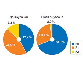 Нові можливості в лікуванні метаболічно-асоційованої стеатотичної хвороби печінки
