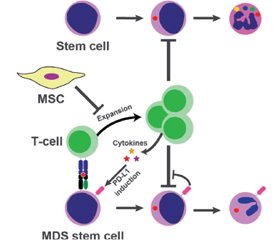 Тривожно-депресивний розлад у хворих на мієлодиспластичний синдром: виклики та рішення