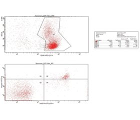 Життєздатність та види клітинної загибелі лейкоцитів у пацієнтів з гострим ішемічним інсультом залежно від тяжкості захворювання